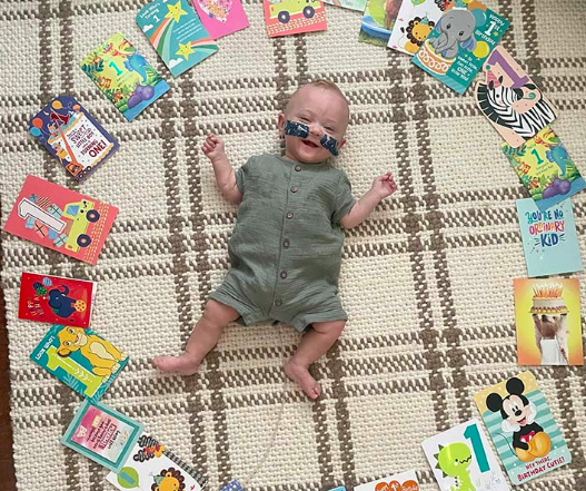 A miracle at 21 weeks: World's most premature baby defies 'phenomenal odds' to celebrate first birthday