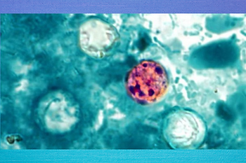 Underwater turquoise water with bubbles and circular orbs, including a purple-orange bubble near the center.